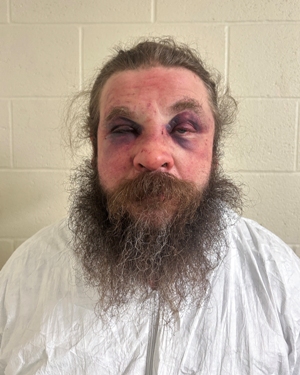 Vermont State Police arrests suspect in connection with Fairfax shooting   
