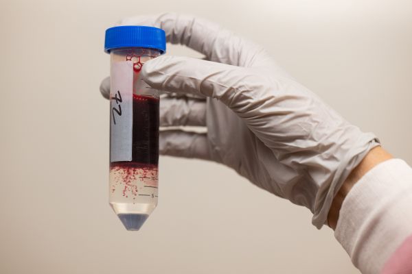 Red blood cells and serum separate after spinning in a centrifuge in the UVM Vaccine Testing Center. 