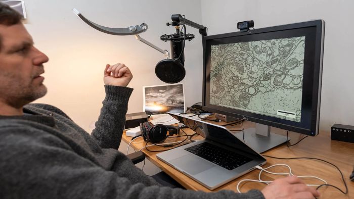 Associate Professor of Neurological Sciences Davi Bock does most of his work in the basement of his 1850s farmhouse at the end of a dirt road in Glover, Vt