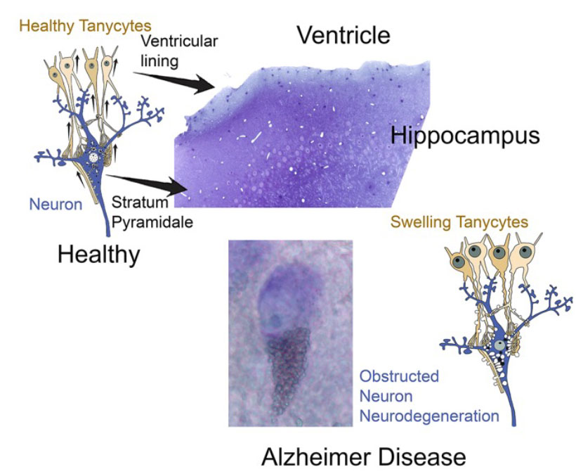 Saint Michael’s College is looking to spiders for Alzheimer's research